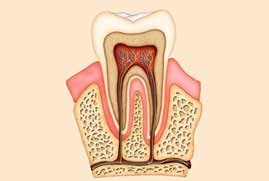 rootcanaltreatment
